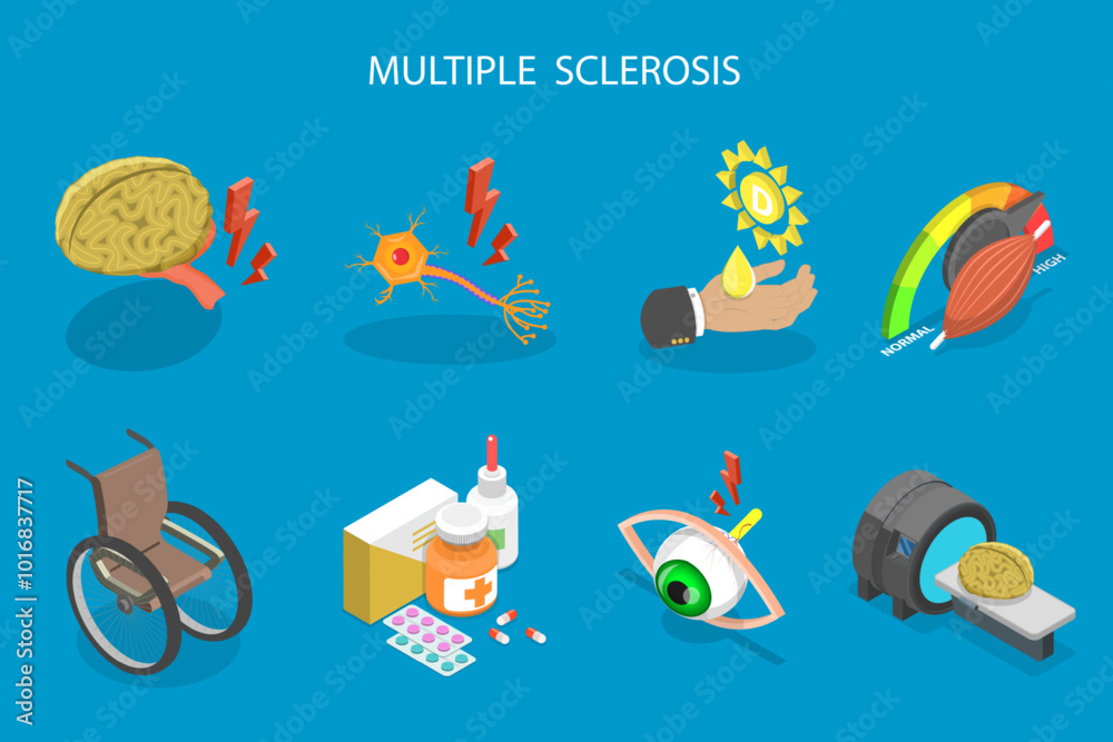 3D Isometric Flat Vector Illustration of Multiple Sclerosis, Nerve Cell Or Brain Spinal Cord Damage 3D Isometric Flat Vector Illustration of Multiple Sclerosis, Nerve Cell Or Brain Spinal Cord Damage