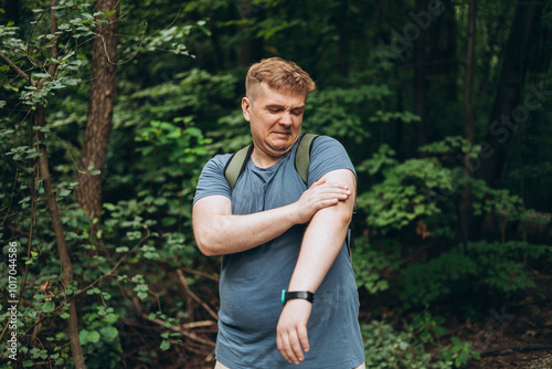 Angry 30s man trying to get rid of annoying insects outdoors. Mosquitoes attack, Healthy lifestyle banner. Threat of malaria