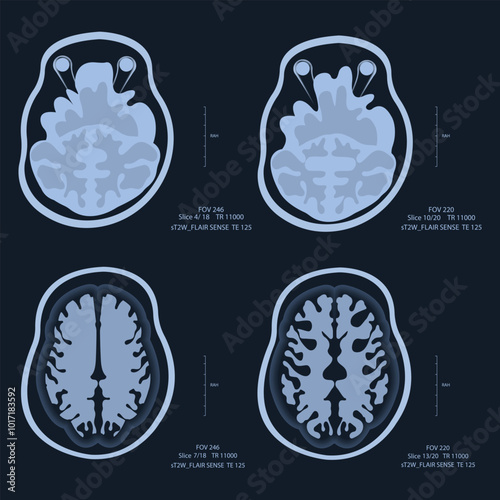 MRI - Magnetic Resonance Imaging - Illustration. X-ray images of the brain