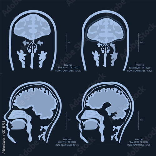 X-ray images of the brain, scanned with MRI or CT. Accept radiology