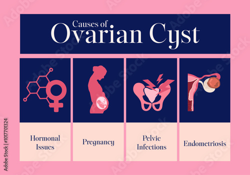 female reproductive system cause of ovarian cyst consist of illustration