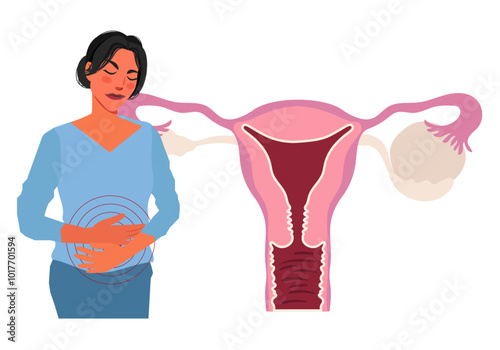 female reproductive system ovarian cyst abdominal pain illustration