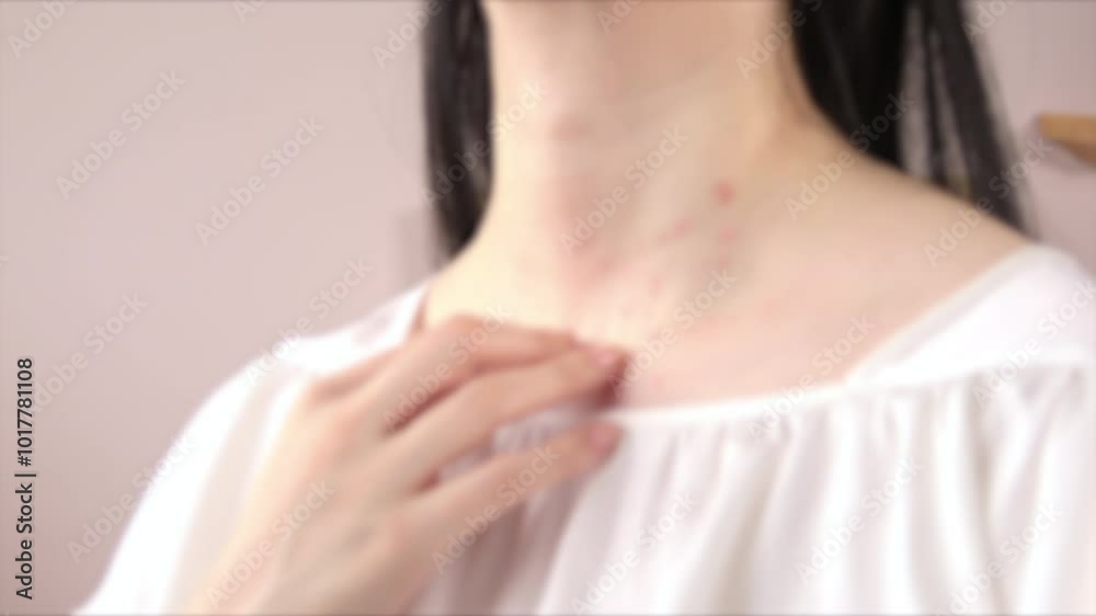 Blurred, closeup shot of a young woman scratching her neck. Defocus shot of itchy body with skin problem. 4K Blurred, closeup shot of a young woman scratching her neck. Defocus shot of itchy body with skin problem. 4K