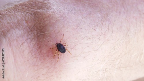 On human skin Mediterranean basin tick species (Hyalomma lusitanicum) vector and reservoir Congo-Crimean hemorrhagic fever. Rapidly spreading species in Europe. Crimea. Arabatskaya strelka photo