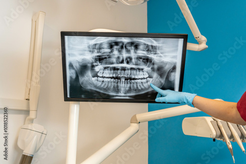 Foto Mano de dentista señalando el tac de la boca de un paciente, en una clínica dental