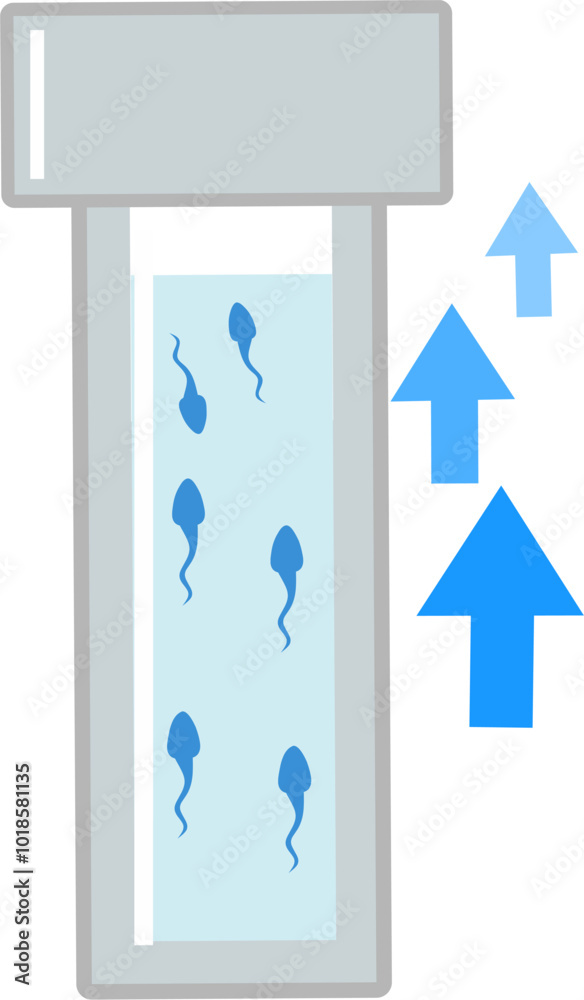Good great healthy sperm analysis count for ivf procedure conceptual illustration of the mciroscope and sperm cells. Fit to show step by step of ivf procedure Good great healthy sperm analysis count for ivf procedure conceptual illustration of the mciroscope and sperm cells. Fit to show step by step of ivf procedure