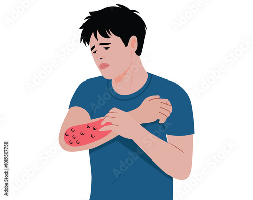 Young man allergy skin itchy symptom in flat design. Red rash skin illustration.