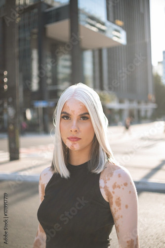 Woman Portrait. Piebald girl in the city photo