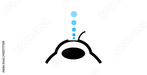 Lasik eye surgery