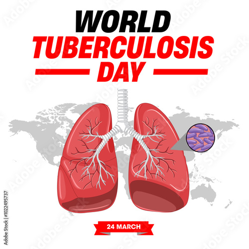World Tuberculosis Day is observed every year on March 24 to raise global awareness about tuberculosis (TB) and efforts to control and eradicate it.