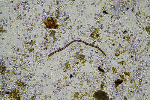 microorganisms and soil biology, with nematodes and fungi under the microscope. in a soil and compost sample photo