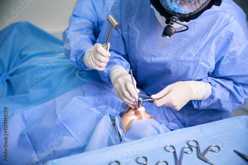 Photography Modern operation to straighten a deviated nasal septum