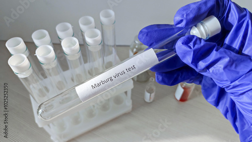 Marburg virus concept: doctor hold a sample of Marburg virus. Marburg fever virus, epidemic of dangerous diseases, Ebola virus photo