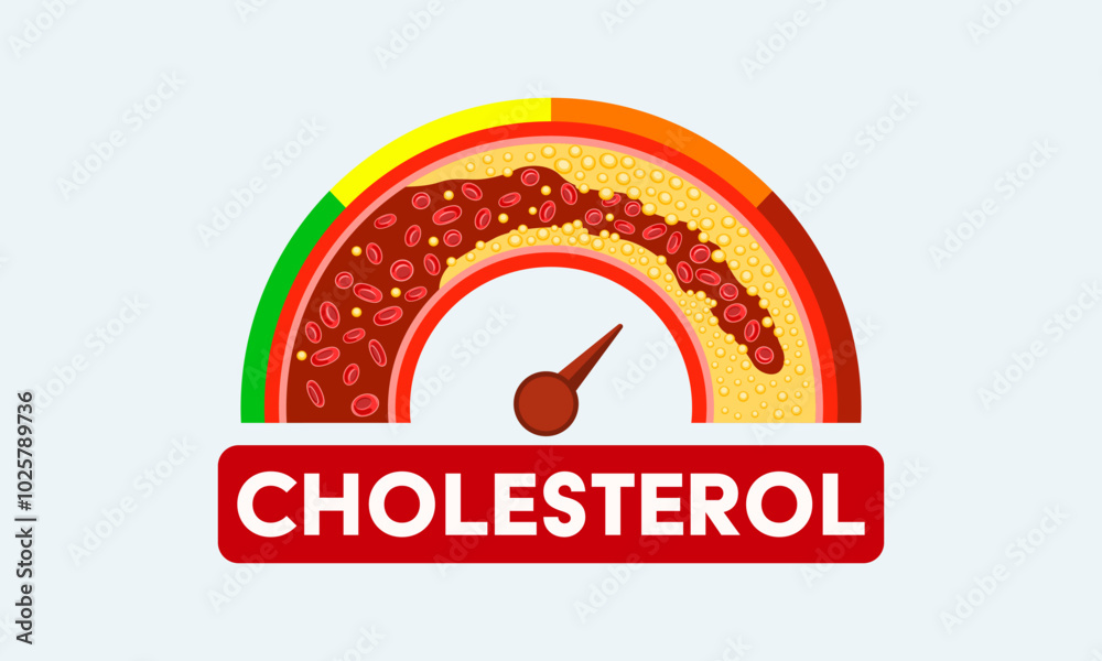 A gauge showing high and low cholesterol levels, arteries with blood fats deposited, the risk of heart disease and stroke, vector illustration