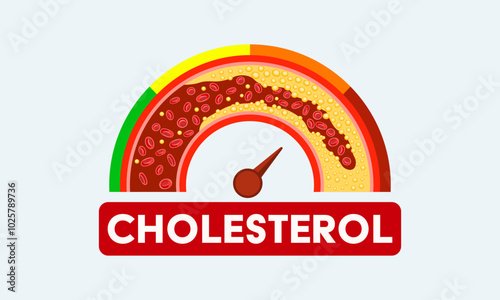 A gauge showing high and low cholesterol levels, arteries with blood fats deposited, the risk of heart disease and stroke, vector illustration