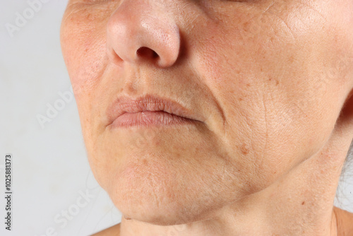 close-up on the wrinkles around the mouth of a 45-year-old woman , nasolabial folds