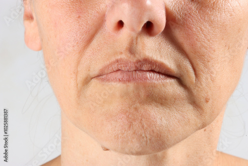 close-up on the wrinkles around the mouth of a 45-year-old woman , nasolabial folds