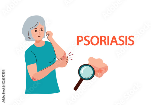 Psoriasis  world day.  caucasian elderly woman suffers from psoriasis. Psoriasis symptoms and reasons infographic. Human skin infection psoriasis diagnosis. Vector hand drawn flat illustration