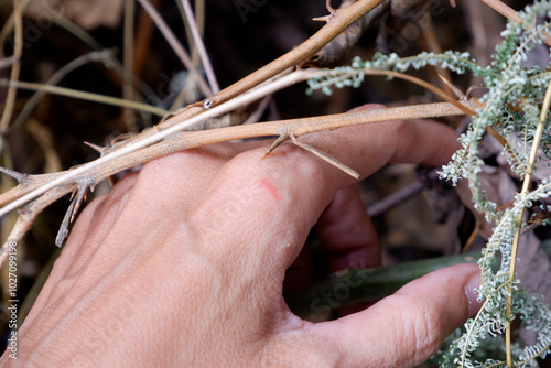 Scratch scar from thorns on the hand.