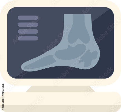 Medical monitor showing human foot x ray scan result, healthcare and medical concept