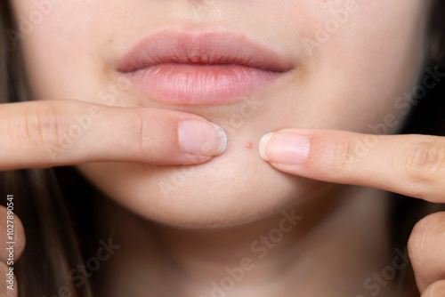 Obraz na plátne Close-up of a woman examining a pimple on her face