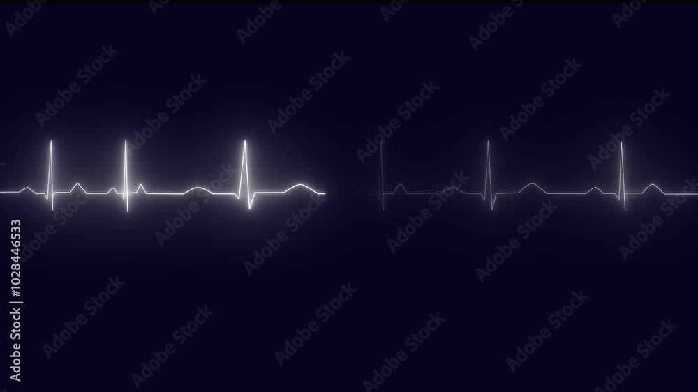 Heartbeat monitor EKG line monitor showing heart pulse .Neon sign heartbeat signal animation , Glowing white color neon heartbeat icon. Heart bit signal animated