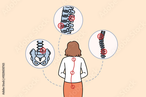 Woman with sore spine stands with back to camera and needs help of massage therapist or osteopath. Businesswoman sore spine appeared as result of sedentary lifestyle and bad office chair.