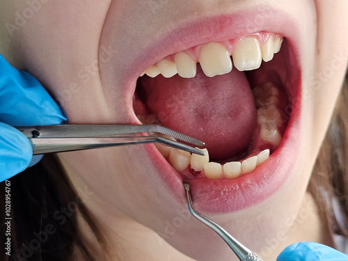 Canvas Print Children teeth