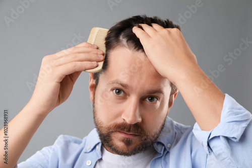 Man brushing his hair on gray background. Alopecia problem