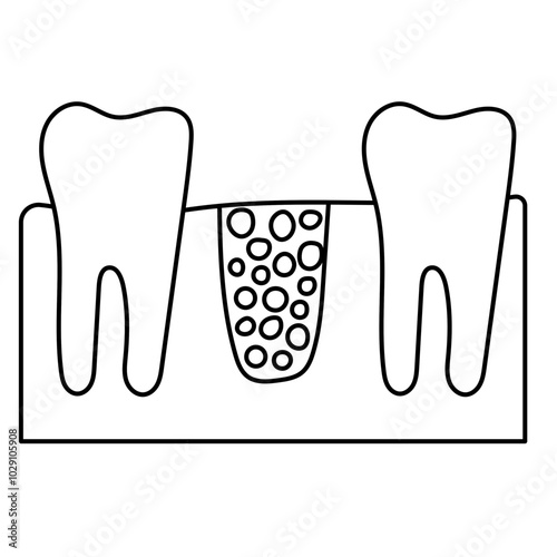 bone graft icon