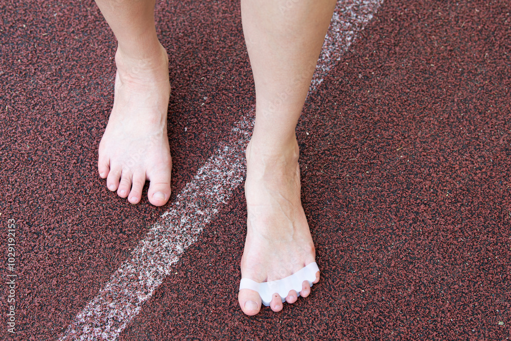 Close-up of female bare feet standing on a textured surface. The feet are wearing in silicone toe separators, promoting toe alignment and foot health. Self-care procedures for healthy feet. Close-up of female bare feet standing on a textured surface. The feet are wearing in silicone toe separators, promoting toe alignment and foot health. Self-care procedures for healthy feet.