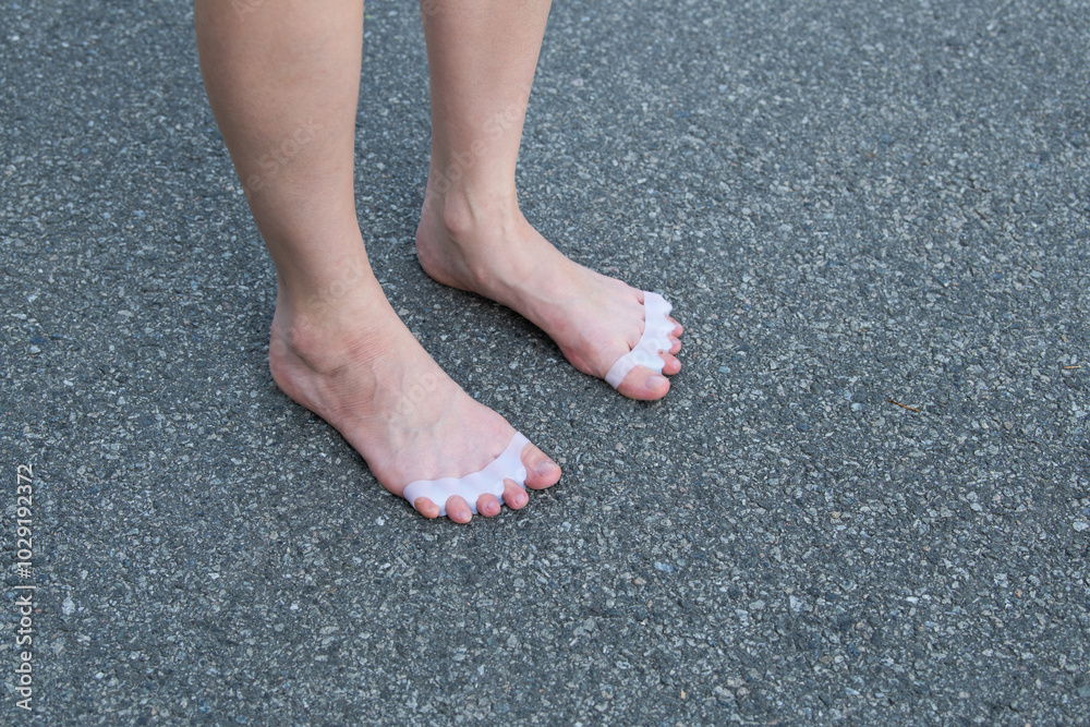 Close-up of female bare feet standing on asphalt. The feet are wearing in silicone toe separators, promoting toe alignment and foot health. Self-care procedures for healthy feet. Close-up of female bare feet standing on asphalt. The feet are wearing in silicone toe separators, promoting toe alignment and foot health. Self-care procedures for healthy feet.