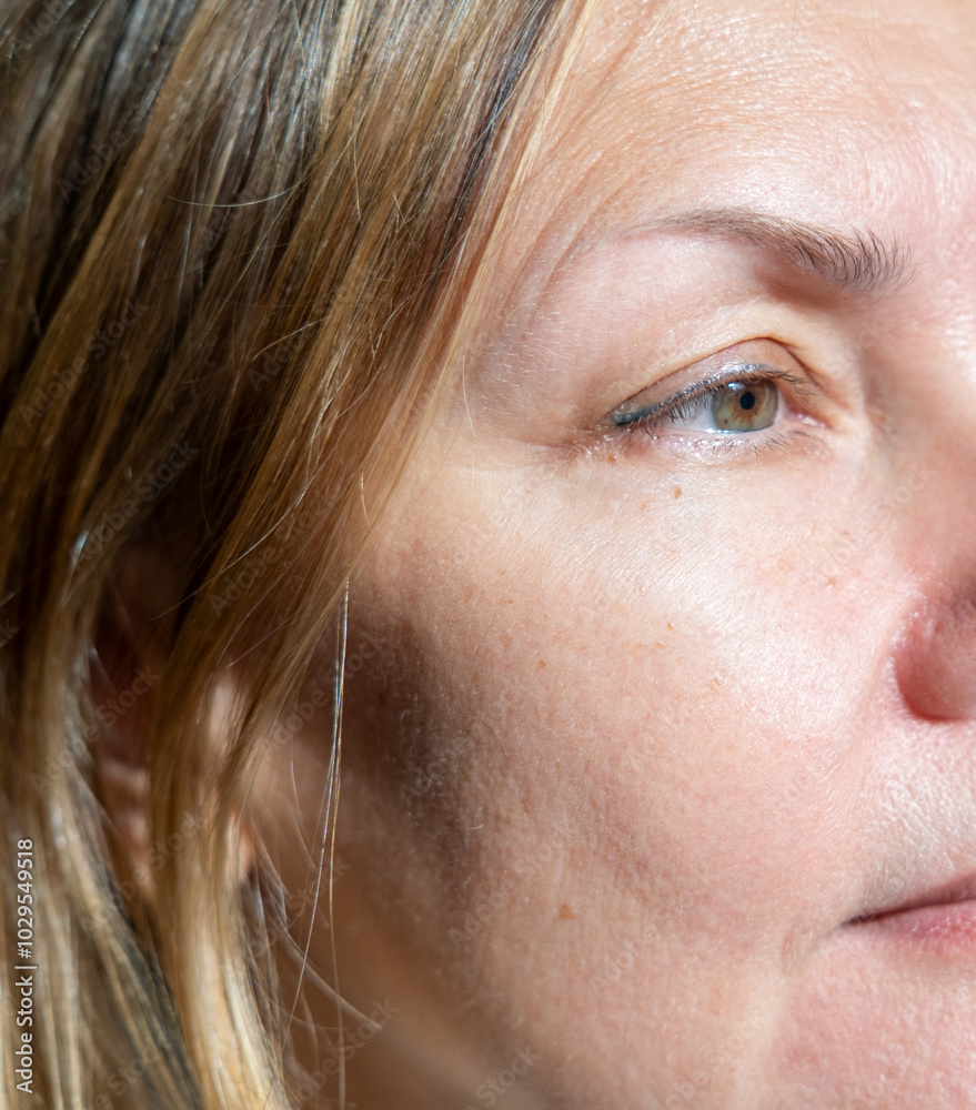 Anti-Age Treatment. Profile of beautiful middle-aged woman with soft skin over dark background, skin condition. Natural beauty. Anti-Age Treatment. Profile of beautiful middle-aged woman with soft skin over dark background, skin condition. Natural beauty.