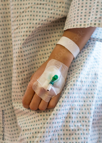 Female arm of young patient in hospital with cannula after surgery. Internal drip device. Postoperative care.