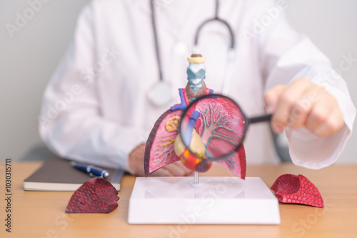 Doctor with Lung anatomy with magnifying glass. Lung Cancer, Asthma, Chronic Obstructive Pulmonary or COPD, Bronchitis, Emphysema, Cystic Fibrosis, Bronchiectasis, Pneumonia and world Lung day photo