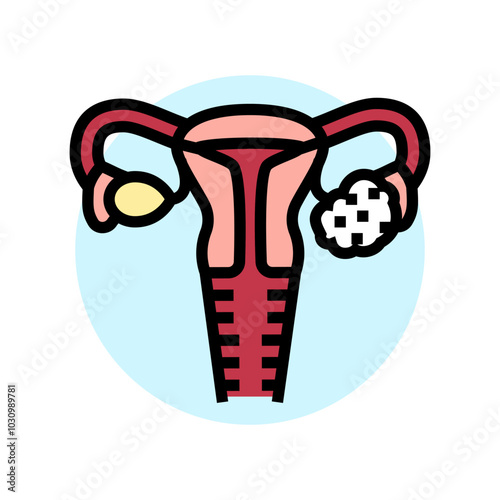 polycystic ovary syndrome woman disease color icon vector. polycystic ovary syndrome woman disease sign. isolated symbol illustration