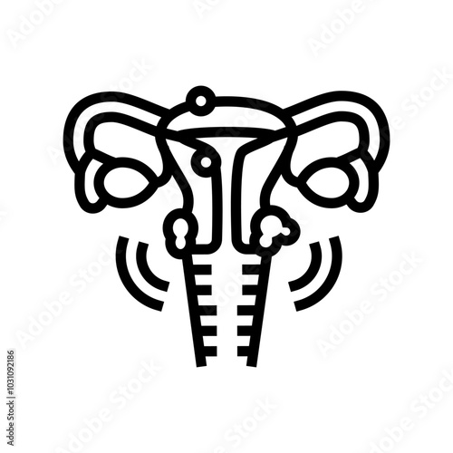 uterine fibroids woman disease line icon vector. uterine fibroids woman disease sign. isolated contour symbol black illustration