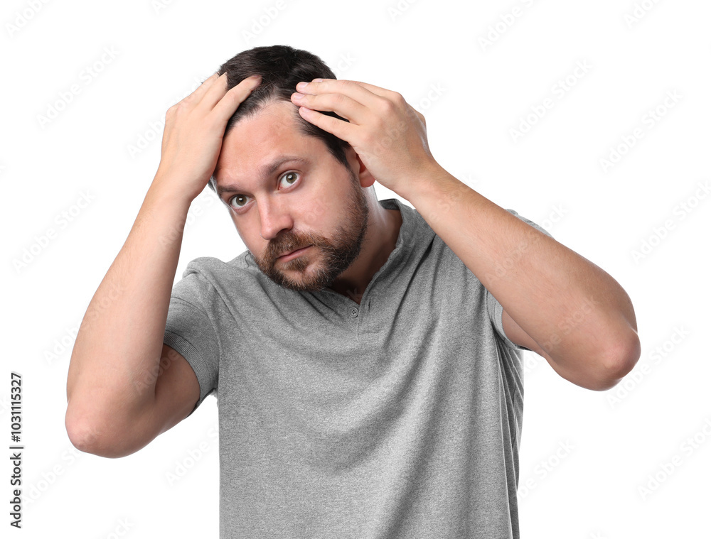 Man with hair loss problem on white background Man with hair loss problem on white background