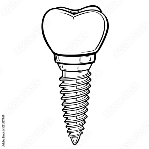 Dental Implant