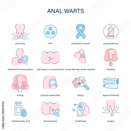 Anal Warts symptoms, diagnostic and treatment vector icons. Medical icons.