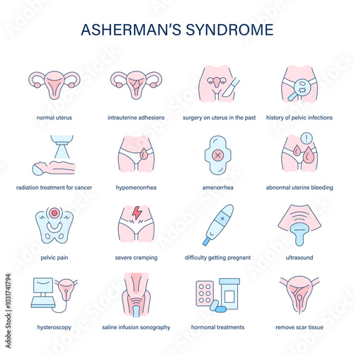 Asherman's Syndrome symptoms, diagnostic and treatment vector icons. Medical icons.
