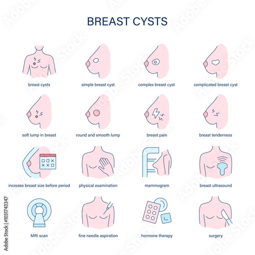 Breast Cysts symptoms, diagnostic and treatment vector icons. Medical icons.