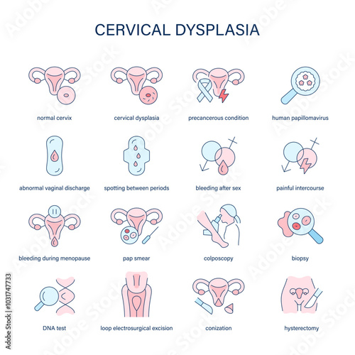 Cervical Dysplasia symptoms, diagnostic and treatment vector icons. Medical icons.