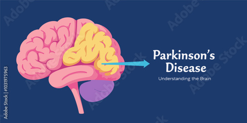 Parkinson's Disease Brain Illustration 
