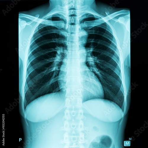An X-ray image of the human...