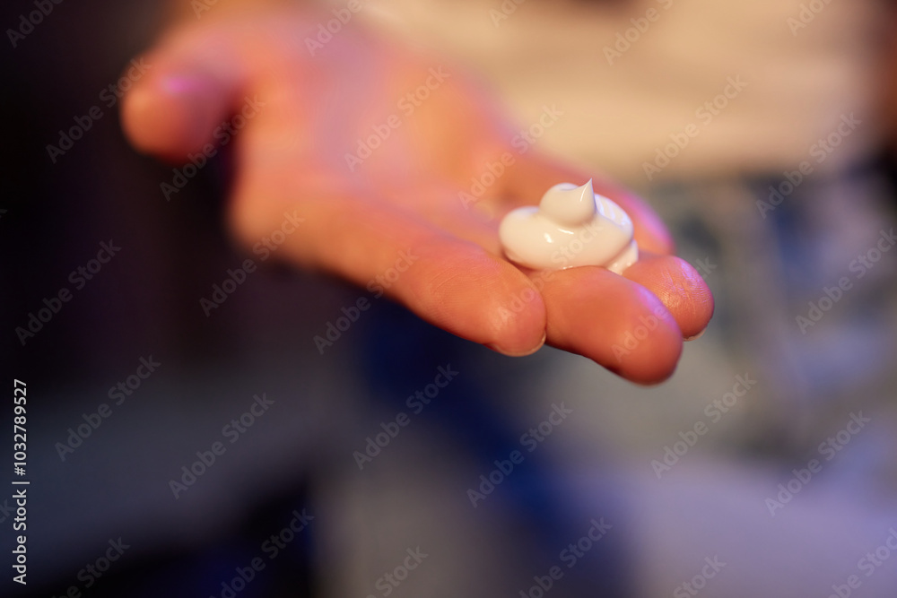 Young woman applying cream on hand against, to dry flaky skin as in the treatment of psoriasis, eczema and other dry skin conditions