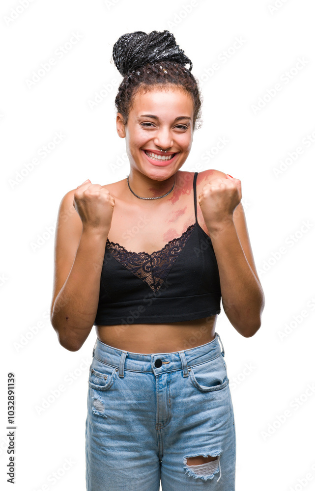 Young braided hair african american with pigmentation blemish birth mark over isolated background celebrating surprised and amazed for success with arms raised and open eyes. Winner concept.