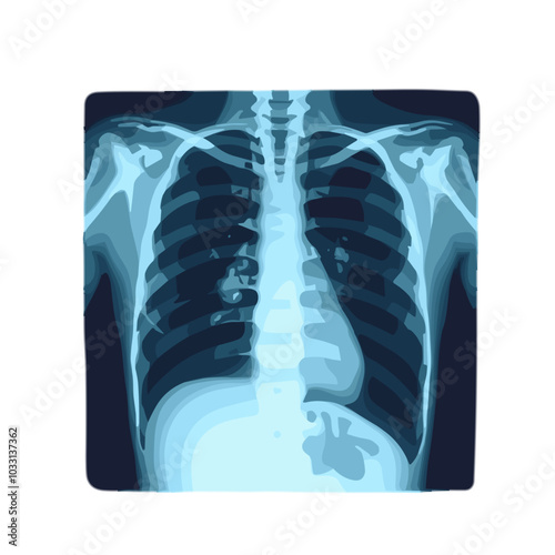 Chest X-ray, medical diagnosis vector illustration