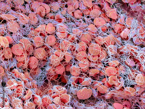 Blood clot, SEM photo