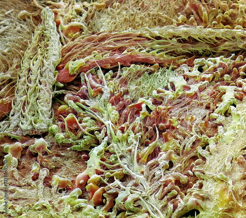 Cannabis plant, SEM photo